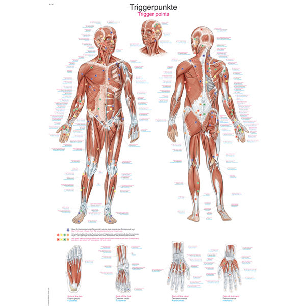 Anatomische Kaart Trigger Points