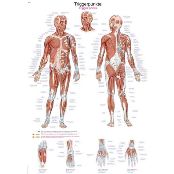 Anatomische Kaart Trigger Points - outlet